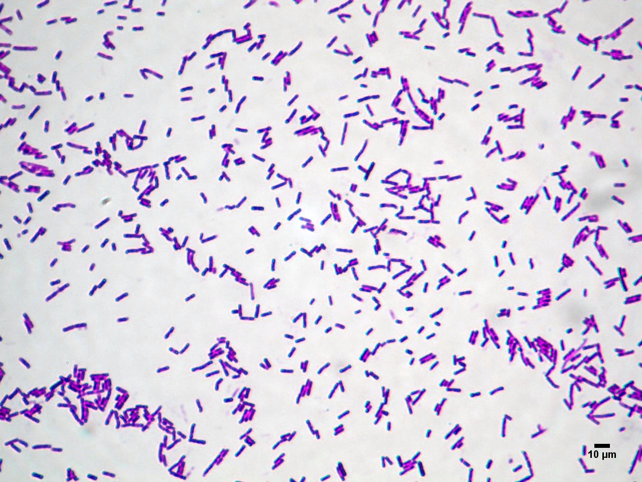 Микропрепарат бактерий. Bacillus subtilis (Сенная палочка). Палочка цереус (Bacillus Cereus). Микропрепарат бактерии Сенной палочки. Bacillus subtilis грамположительные.