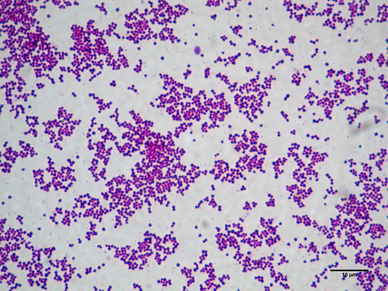 Staphylococcus Aureus