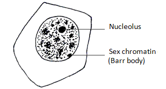 buccal smear chromatin negative nuclei